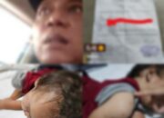 Ibu Muda Ini Berjuang Sendiri Obati Anak yang Diduga Derita Tumor dan Penyakit Kulit, Desak Tanggung Jawab Ayah Biologis