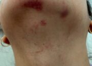 PERKARA KDRT MANDEK SEJAK TAHUN 2024, KUASA HUKUM KORBAN SOROTI KINERJA UNIT PPA POLRES TANGERANG SELATAN